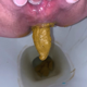 In 2 scenes, a fat girl takes a shit while sitting on a toilet and recording the poop action from a between the legs perspective. She shows off her product and picks the poop out of the toilet bowl. Over 7 minutes.